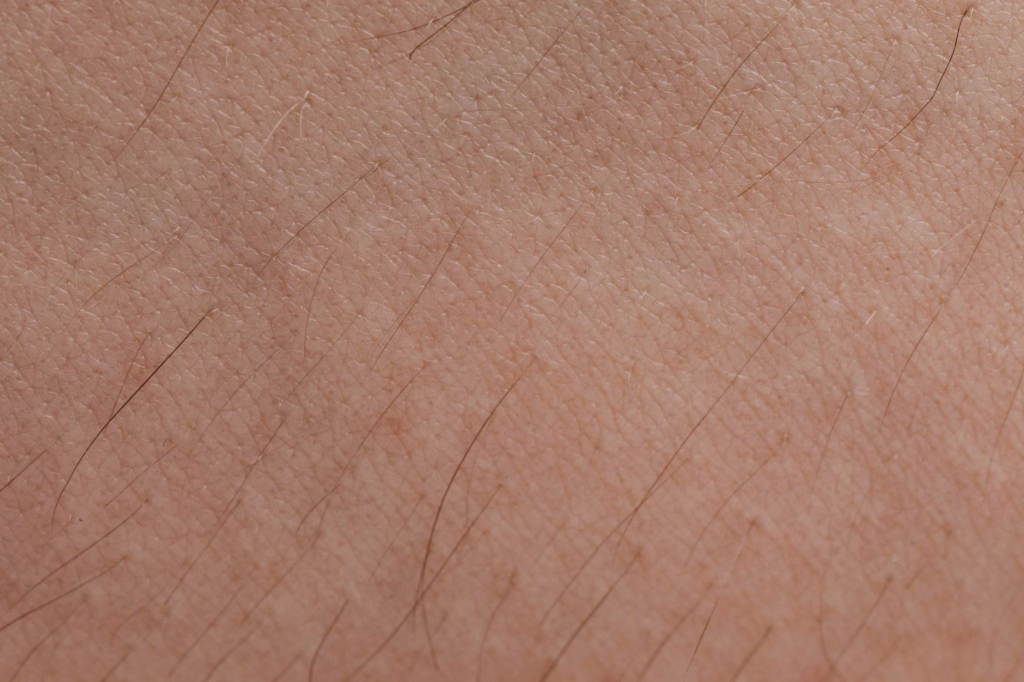 Close-up of goosebumps on human skin showing why do we get goosebumps
